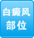 白癜風(fēng)醫(yī)院