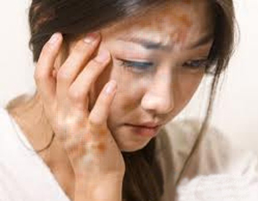 女性白癜風(fēng)護(hù)理注意事項(xiàng) 